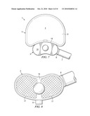 MINIMALLY INVASIVE EXPANDABLE VERTEBRAL IMPLANT AND METHOD diagram and image