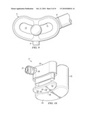 MINIMALLY INVASIVE EXPANDABLE VERTEBRAL IMPLANT AND METHOD diagram and image