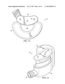 MINIMALLY INVASIVE EXPANDABLE VERTEBRAL IMPLANT AND METHOD diagram and image