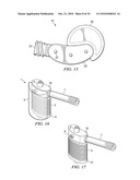 MINIMALLY INVASIVE EXPANDABLE VERTEBRAL IMPLANT AND METHOD diagram and image