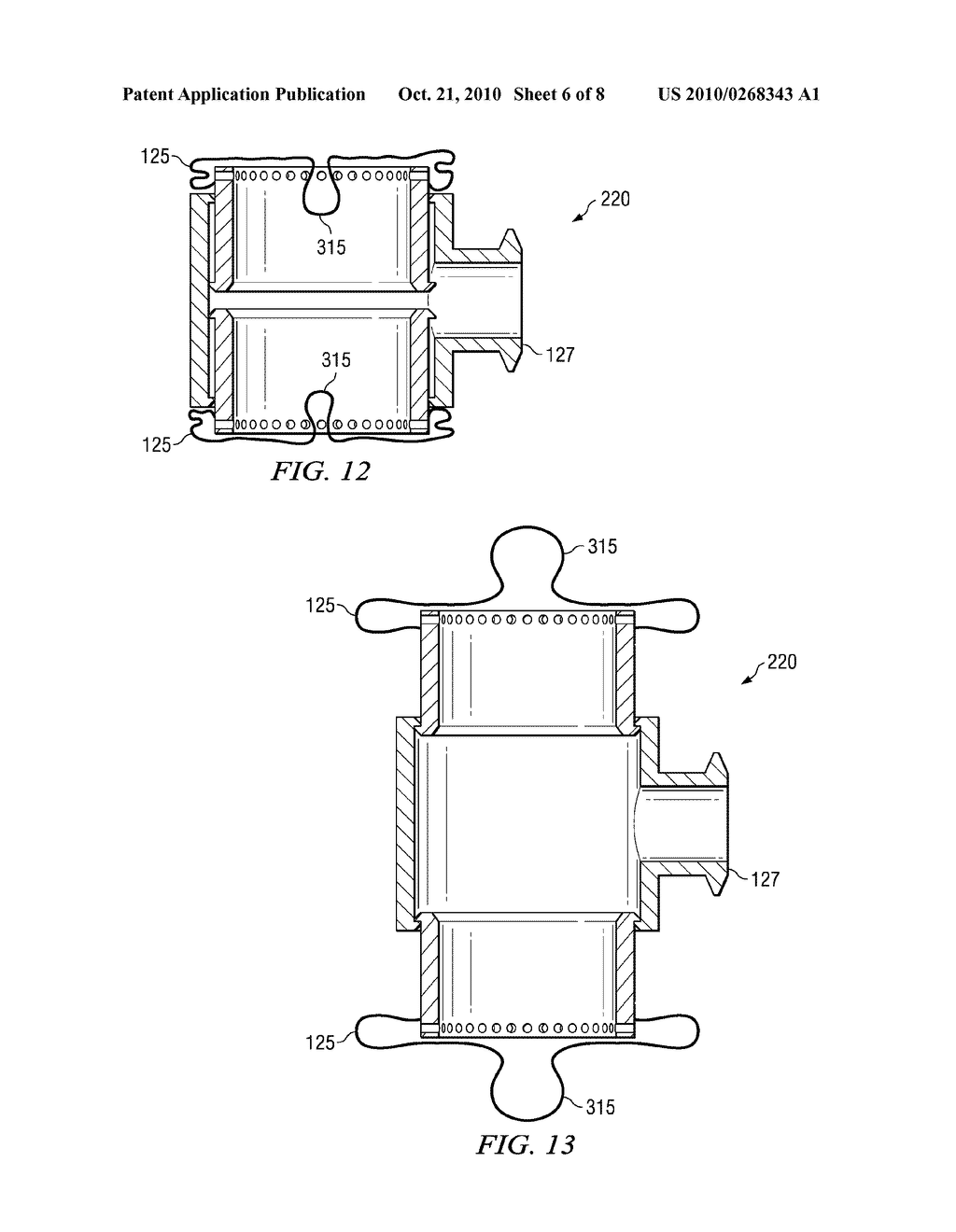 VERTEBRAL ENDPLATE CONNECTION IMPLANT AND METHOD - diagram, schematic, and image 07