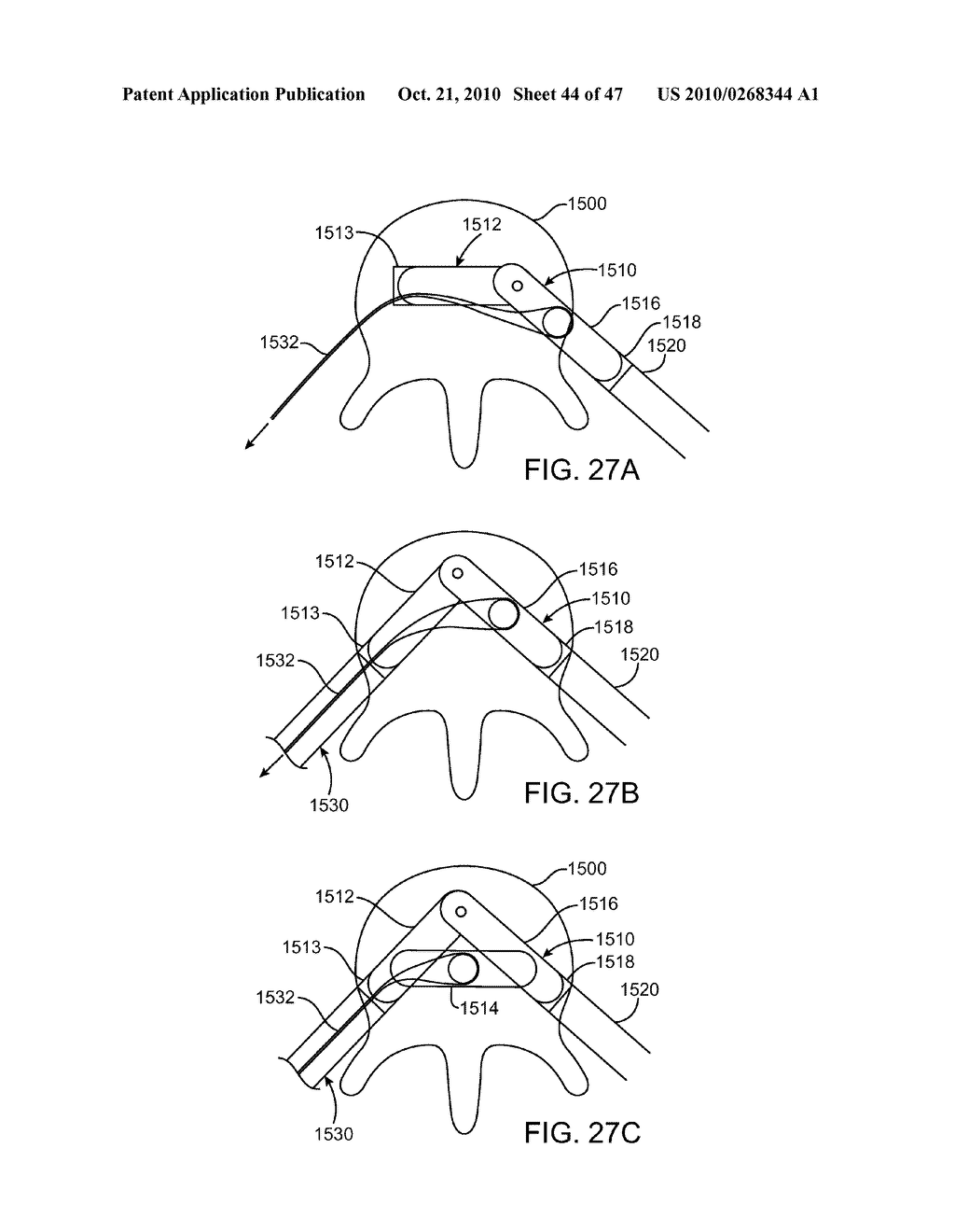 Posterior Spinal Device and Method - diagram, schematic, and image 45