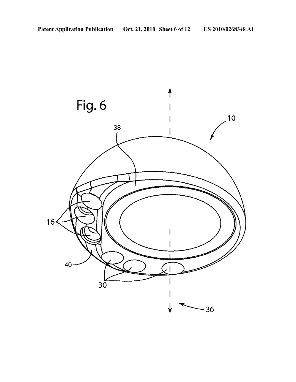 Acetabular Cup - diagram, schematic, and image 07