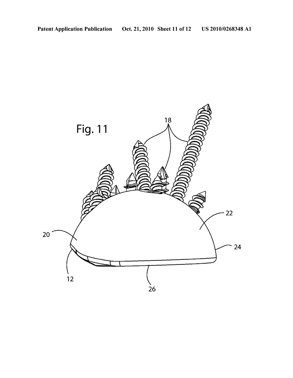 Acetabular Cup - diagram, schematic, and image 12