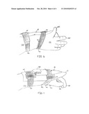 BALLISTIC HAND PROTECTOR diagram and image