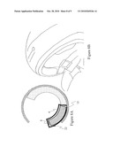 SAFETY HELMET ADAPTED FOR QUICK AND EASY EMERGENCY REMOVAL diagram and image