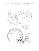 SAFETY HELMET ADAPTED FOR QUICK AND EASY EMERGENCY REMOVAL diagram and image