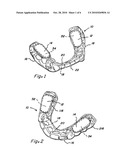 COMPOSITE ORAL APPLIANCES AND METHODS FOR MANUFACTURE diagram and image