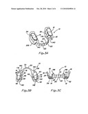 COMPOSITE ORAL APPLIANCES AND METHODS FOR MANUFACTURE diagram and image