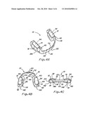 COMPOSITE ORAL APPLIANCES AND METHODS FOR MANUFACTURE diagram and image