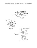 COMPOSITE ORAL APPLIANCES AND METHODS FOR MANUFACTURE diagram and image