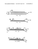 Collector grid and interconnect structures for photovoltaic arrays and modules diagram and image