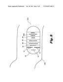 MULTIPLE CAPSULE CAMERA APPARATUS AND METHODS FOR USING THE SAME diagram and image