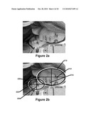 Perfecting of Digital Image Capture Parameters Within Acquisition Devices Using Face Detection diagram and image