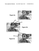 Perfecting of Digital Image Capture Parameters Within Acquisition Devices Using Face Detection diagram and image