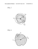 Method and Apparatus for Small Pulmonary Nodule Computer Aided Diagnosis from Computed Tomography Scans diagram and image