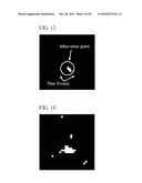 Method and Apparatus for Small Pulmonary Nodule Computer Aided Diagnosis from Computed Tomography Scans diagram and image