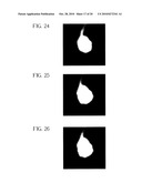 Method and Apparatus for Small Pulmonary Nodule Computer Aided Diagnosis from Computed Tomography Scans diagram and image