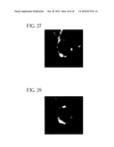 Method and Apparatus for Small Pulmonary Nodule Computer Aided Diagnosis from Computed Tomography Scans diagram and image