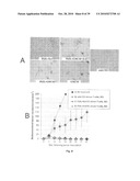 DENDRITIC CELL PRECURSORS diagram and image