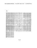 DENDRITIC CELL PRECURSORS diagram and image