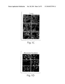 CATHEPSIN L MEDIATED DISEASES AND ASSOCIATED METHODS AND PRODUCTS diagram and image