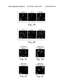 CATHEPSIN L MEDIATED DISEASES AND ASSOCIATED METHODS AND PRODUCTS diagram and image