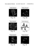 CATHEPSIN L MEDIATED DISEASES AND ASSOCIATED METHODS AND PRODUCTS diagram and image