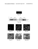 CATHEPSIN L MEDIATED DISEASES AND ASSOCIATED METHODS AND PRODUCTS diagram and image