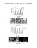 CATHEPSIN L MEDIATED DISEASES AND ASSOCIATED METHODS AND PRODUCTS diagram and image