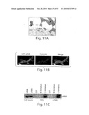 CATHEPSIN L MEDIATED DISEASES AND ASSOCIATED METHODS AND PRODUCTS diagram and image