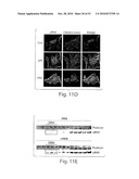 CATHEPSIN L MEDIATED DISEASES AND ASSOCIATED METHODS AND PRODUCTS diagram and image