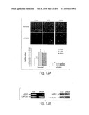 CATHEPSIN L MEDIATED DISEASES AND ASSOCIATED METHODS AND PRODUCTS diagram and image