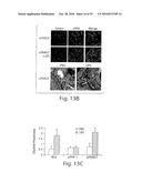 CATHEPSIN L MEDIATED DISEASES AND ASSOCIATED METHODS AND PRODUCTS diagram and image