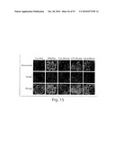 CATHEPSIN L MEDIATED DISEASES AND ASSOCIATED METHODS AND PRODUCTS diagram and image