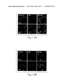 CATHEPSIN L MEDIATED DISEASES AND ASSOCIATED METHODS AND PRODUCTS diagram and image