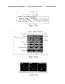 CATHEPSIN L MEDIATED DISEASES AND ASSOCIATED METHODS AND PRODUCTS diagram and image