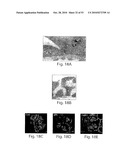 CATHEPSIN L MEDIATED DISEASES AND ASSOCIATED METHODS AND PRODUCTS diagram and image