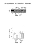 CATHEPSIN L MEDIATED DISEASES AND ASSOCIATED METHODS AND PRODUCTS diagram and image