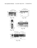 CATHEPSIN L MEDIATED DISEASES AND ASSOCIATED METHODS AND PRODUCTS diagram and image