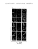 CATHEPSIN L MEDIATED DISEASES AND ASSOCIATED METHODS AND PRODUCTS diagram and image