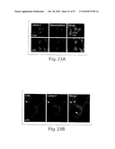 CATHEPSIN L MEDIATED DISEASES AND ASSOCIATED METHODS AND PRODUCTS diagram and image