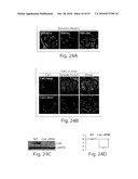 CATHEPSIN L MEDIATED DISEASES AND ASSOCIATED METHODS AND PRODUCTS diagram and image