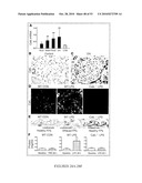 CATHEPSIN L MEDIATED DISEASES AND ASSOCIATED METHODS AND PRODUCTS diagram and image