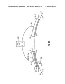 Method for transdermal iontophoretic delivery of chelated agents diagram and image