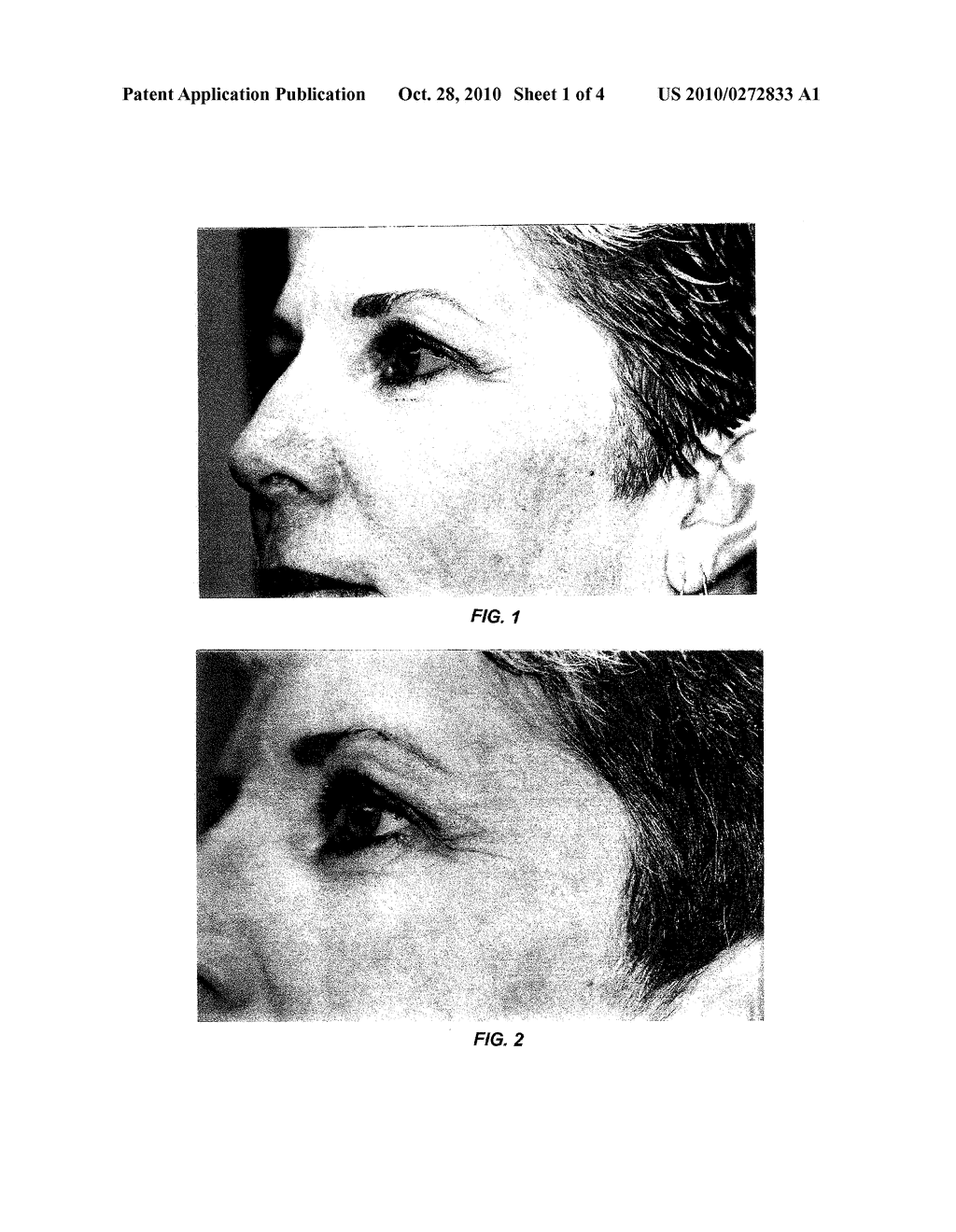 TOPICAL COMPOSITIONS FOR ANTI-AGING AND METHODS OF USING SAME - diagram, schematic, and image 02