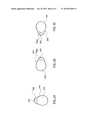 Melt Channel Geometries for an Injection Molding System diagram and image