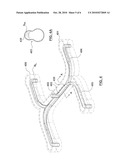 Melt Channel Geometries for an Injection Molding System diagram and image