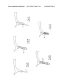 SET OF MOTOR-DRIVEN INSTRUMENTS TO AID THE FIXING OF DENTAL IMPLANTS diagram and image