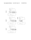 SET OF MOTOR-DRIVEN INSTRUMENTS TO AID THE FIXING OF DENTAL IMPLANTS diagram and image